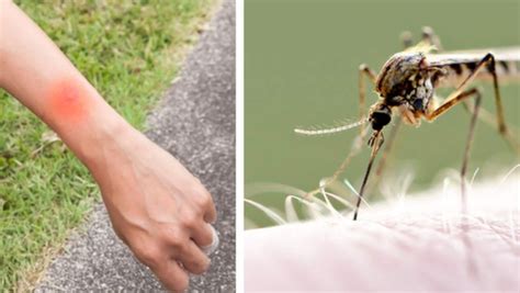 Allergisk mot myggbett